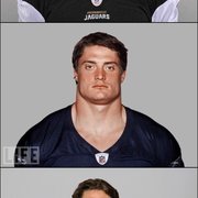 NFL 선수들의 흔한 목두께