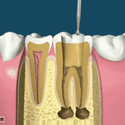 치과 의사 언어 해석